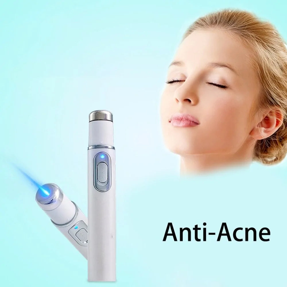 Kingdomcares Blue Light Therapy Acne Laser Pen